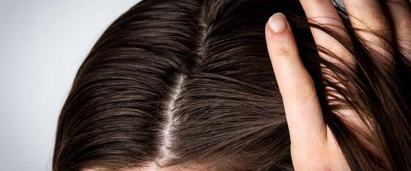 Jak skutecznie zadbać o mocno przetłuszczające się włosy? Sprawdzone metody i porady